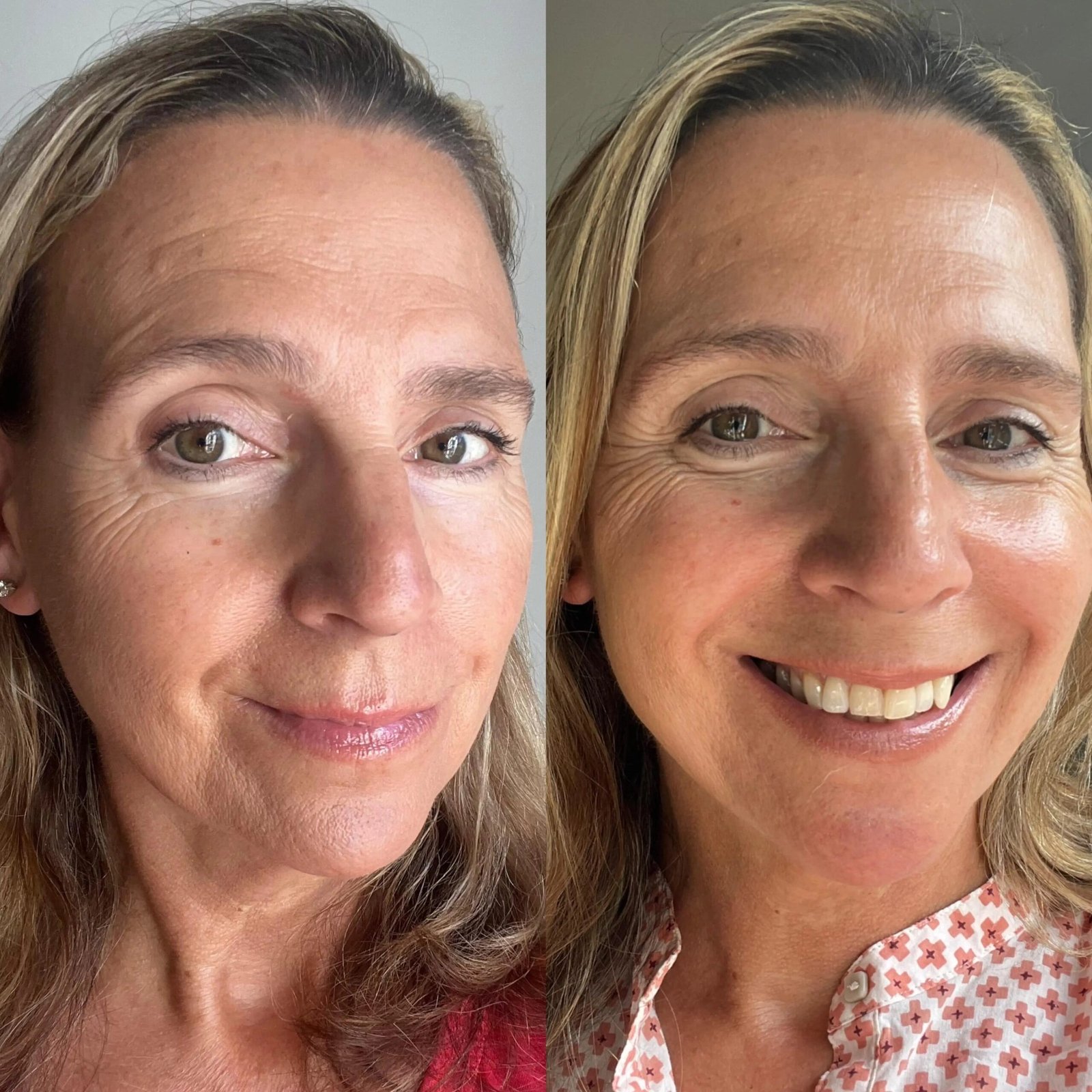 Dusk to Dawn - Overnight Tan Facial - Image 4